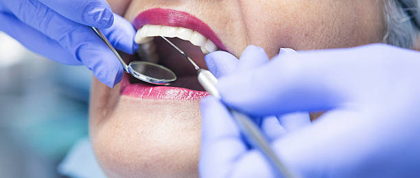 Best Emergency Dental Care for Trauma or Injury in Lincoln, AL